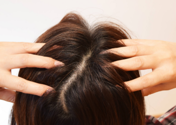 Câncer de pele no couro cabeludo dificulta diagnóstico e atrasa tratamento