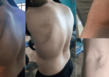 Brasil não autorizou continuação do voo e diz que algemas é violação