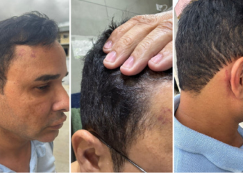 Sargento da PM nega ter dado soco em mulher e alega ter sido agredido