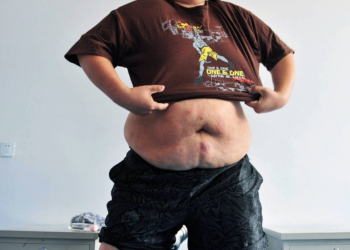 Comissão global propõe mudanças no diagnóstico de obesidade, restringindo uso do IMC