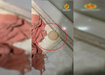 Mulher tem silicone arrancado com faca de cozinha após brigar com marido