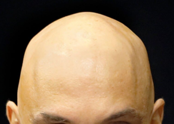 A calvície de Alexandre de Moraes, uma investigação intelectual