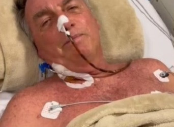 Médicos encerram cirurgia de Bolsonaro; quadro é estável