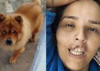 Sem avisar, marido manda matar chow-chow que arrancou lábio de mulher