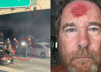 Protestos em Los Angeles: fotógrafo de tabloide conservador é atingido na cabeça por bala de borracha; VEJA