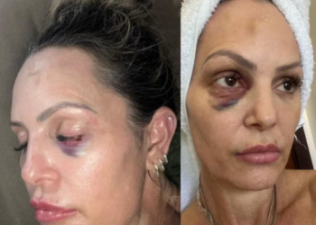 Policial civil que espancou ex-namorada é condenado a 15 anos de prisão