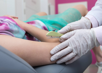 Planos de saúde já são obrigados a cobrir implante contraceptivo Implanon