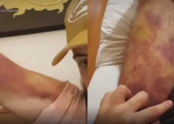 'Se não atinge meta, leva choque': brasileiros relatam drama após serem aliciados por rede internacional de tráfico humano no Sudeste Asiático