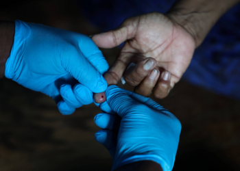 Por que diabetes tipo 1 é mais grave em crianças pequenas