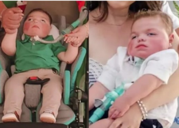 Criança morre aos 5 anos após lutar contra doença rara no PR