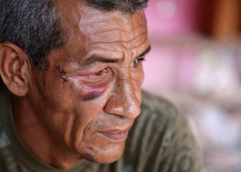 'Nunca pensei que fossem me atacar': os sobreviventes de ataque com míssil durante bombardeios dos EUA à Venezuela