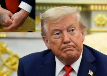 Trump atribui à aspirina hematomas nas mãos e nega cochilar em público