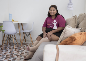 Mulheres com lipedema têm diagnóstico tardio e dificuldade de acesso a tratamento