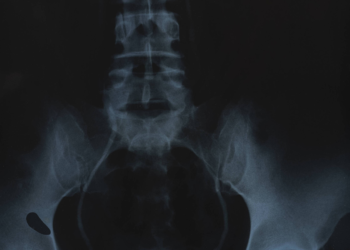 Anna Maria Maiolino ganha exposição em que usa a arte para radiografar o corpo